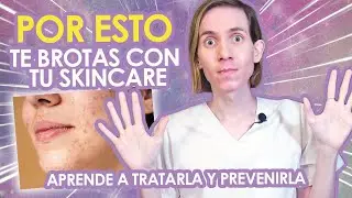 PURGA: POR ESTO te BROTAS AL USAR tus PRODUCTOS DE SKINCARE -  ¿Qué es y cómo tratarla?