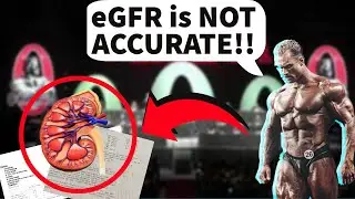 Is eGFR Accurate? | Improve Kidney Function In Seconds! | Doctor's Analysis