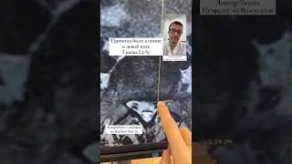 Грыжа L5-S1. Причина боли в спине и левой ноге.