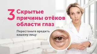 ОТЁКИ И МЕШКИ под глазами: НЕОЖИДАННЫЕ причины и одно полезное упражнение