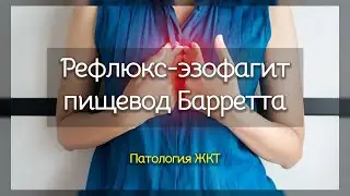 Рефлюкс эзофагит и пищевод Барретта | Патология