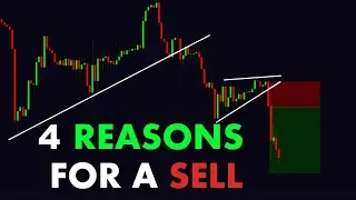 4 REASONS FOR A SELL #ChartPatterns Candlestick | Stock | Market | Forex | crypto | Trading | New