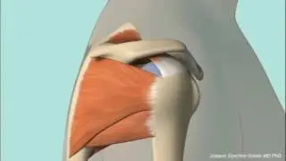 Chronic Subacromial Impingement Animation