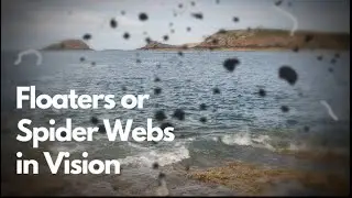 Seeing Floaters or Spider Webs in Vision - EXPLAINED! | Dr. D'Orio Eyecare