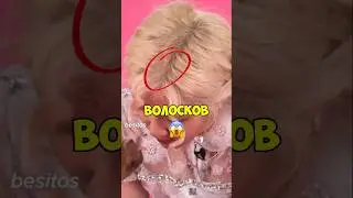РОЗЕ СКОРО СТАНЕТ ЛЫСОЙ⁉️😥      #кпоп #айдолы #блекпинк #лиса #крея #бтс #чонгук #стрейкидс #хёнджин