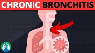 Chronic Bronchitis (Medical Definition)  Quick Explainer Video