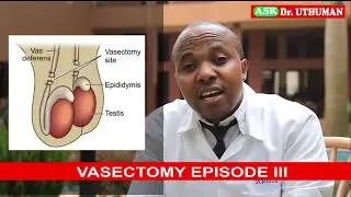 Difference between CASTRATION & VASECTOMY(VASECTOMY episode III)Benefits of vasectomy, can i reverse