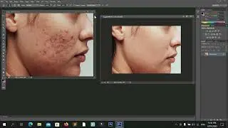 How to Remove Face Spots Quickly on Photoshop CS6 Tutorial 2023