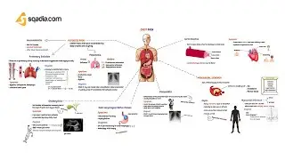 Chest Pain | Pathophysiology and Differentials | USMLE | Medical Student Animation