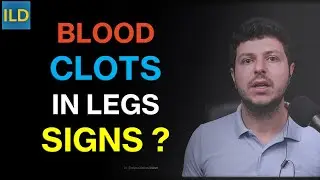 Blood clots in the legs - recognize the signs and risk