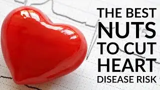 4 Healthiest Nuts to Eat for Your Heart