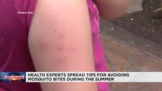 Health experts warn of dangers of mosquito bites