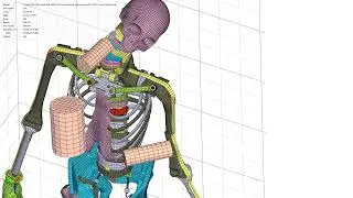 Impetus simulation of Biofidelic-Dummy impact