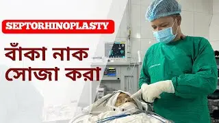 বাঁকা নাক সোজা করা | Septorhinoplasty | Rhinoplasty in Bangladesh | Dr Iqbal Ahmed | Nose Job