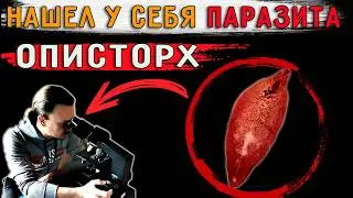 Нашел у себя под микроскопом описторхов! Пропил антипаразитарку. Что стало?