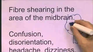 Head Injuries 6, Concussion (mild traumatic brain injury)