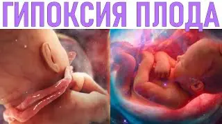 ГИПОКСИЯ ПЛОДА ВО ВРЕМЯ БЕРЕМЕННОСТИ | Что это и от чего она зависит