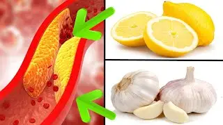 How Unclog Arteries With Lemon and Garlic Juice