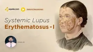 Systemic Lupus Erythematosus - I | Rheumatology Lectures | Medical Education | V-Learning