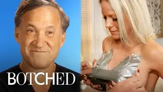 12 Most INSANE Breast Jobs of "Botched"-mas | Botched | E!