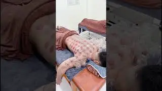 [ASMR] 拔罐 - Cupping Theraphy 