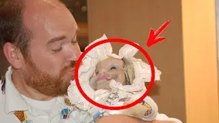 This baby scared the whole internet! This is what happened to him after 5 years!