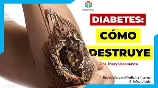 ▷ LO QUE LA DIABETES HACE AL CUERPO 🩸