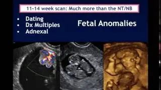 AIUM Webinar: Systematic Evaluation of the 11-14 Week Fetus, Touching on ISUOG Guidelines