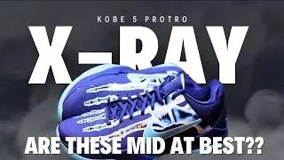 Kobe X-Ray: Essential or Costly Mistake?