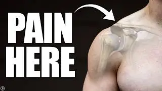 Acromioclavicular (AC) Joint Sprain | Separated Shoulder Rehab (Education & Exercises)