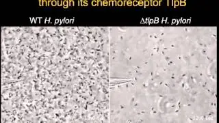 Helicobacter pylori Senses Urea as an Attractant through Its Chemoreceptor TlpB