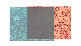 https ::mobile twitter com:MicrobiomDigest:status:1632445121450110978