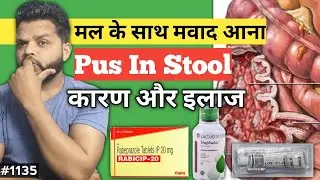 मल के साथ मवाद आता है कारण ओर इलाज | Pus In Stool In Hindi #gyanear