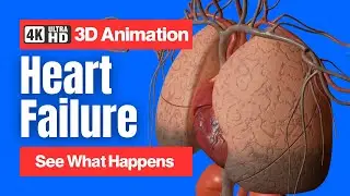 Heart Failure - See What Happens - 