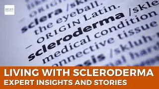 Living with Scleroderma: Expert Insights and Personal Stories