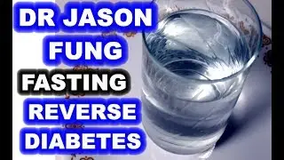 Intermittent Fasting - Looking at the Views of Dr. Jason Fung