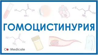 Гомоцистинурия - что такое, механизм развития, симптомы, принцип лечения