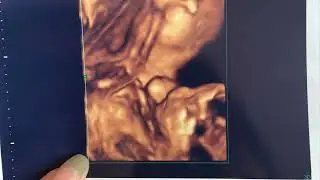 Babaya Doğum Günü Sürprizi !!!