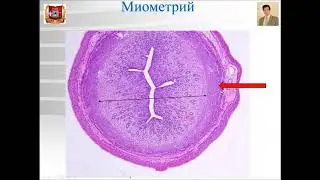 Лекция № 27. Женская половая система -2. Лекция по гистологии