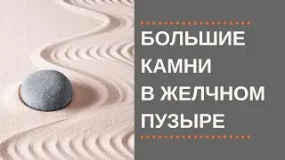 Большие Камни в Желчном.  Больше 2 см.  Что делать?