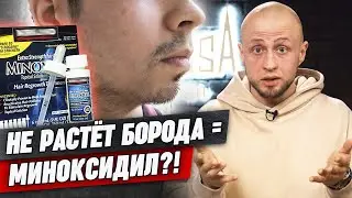 Почему не растет борода? Как на самом деле работает МИНОКСИДИЛ?