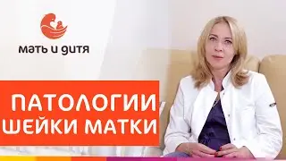 👩 Обследование и лечение патологии шейки матки. Патологии шейки матки лечение. MD GROUP. 18+