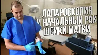 Лапароскопия и начальный рак ш.м. Оводенко Д.Л. Москва.