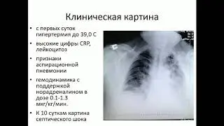 Инотропы и вазопрессоры в управлении гемодинамикой Сычев А.А.