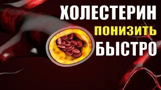 СРОЧНОЕ СНИЖЕНИЕ УРОВНЯ ХОЛЕСТЕРИНА💡ИСЦЕЛЕНИЕ ЗВУКОМ💡ЛЕЧЕБНЫЕ ЧАСТОТЫ (Гц)