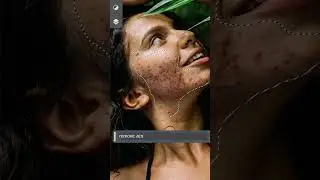 How To Remove Acne with Ai in Photoshop 