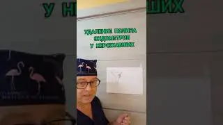 ПОЛИП МАТКИ У НЕРОЖАВШЕЙ. ЧТО ДЕЛАТЬ?