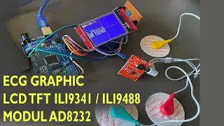 ECG graphic Arduino LCD TFT ILI9341 / ILI9488 Sensor Modul AD8232