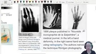 24.1a X-ray Tube and Continuous Spectrum | A2 Medical Physics | Cambridge A Level Physics