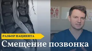 Боль в спине, когда стою | Смещение позвонка и нестабильность | Тесты и упражнения при боли